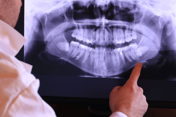 Best Emergency Treatment for Dental Infections or Abscesses in Nellis Af, NV